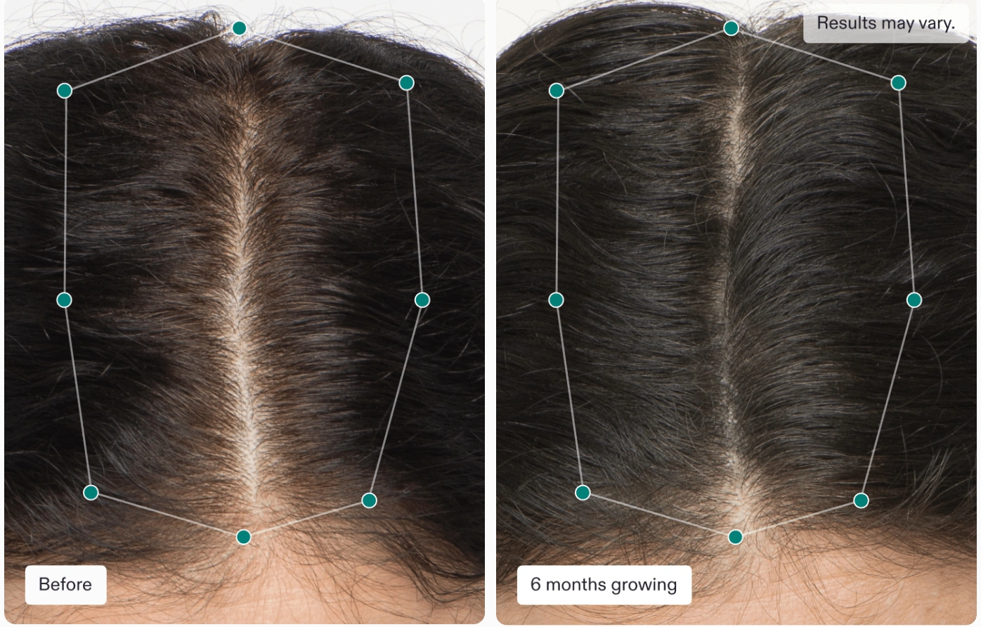 Nutrafol Women's Balance 3 Month Supply | Ashburn, VA | Amy Aesthetics